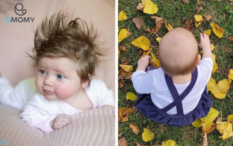 چرا بعضی از نوزادان مو دارند و برخی دیگر نه؟