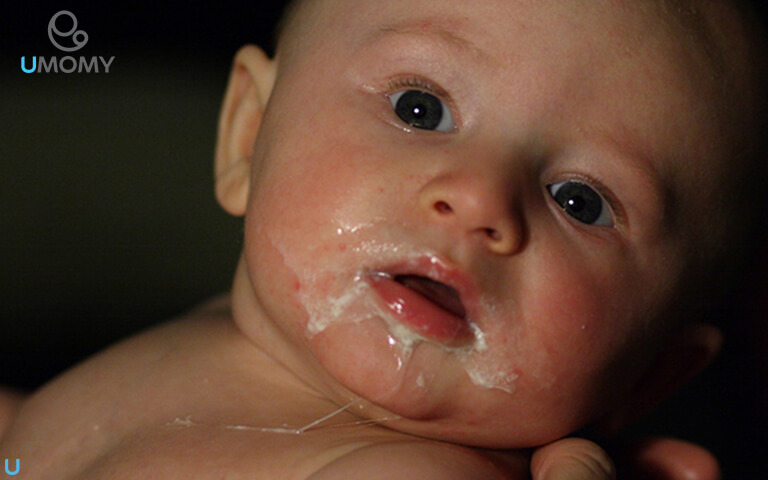 رژیم غذایی مادر برای رفلاکس نوزاد چیست؟