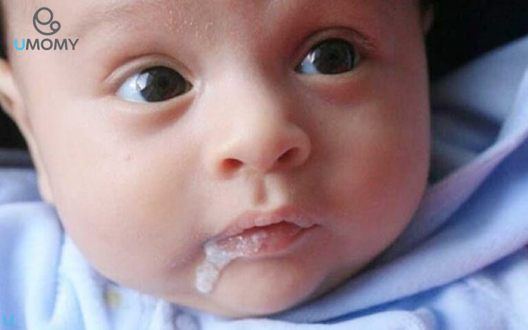 آشنایی با علل متعدد رفلاکس در نوزادان و نقش شیردهی به نوزاد رفلاکسی